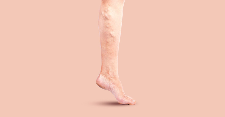 360 * 216px