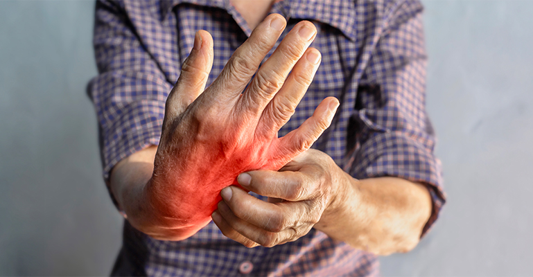 Ayurveda for Rheumatoid Arthritis